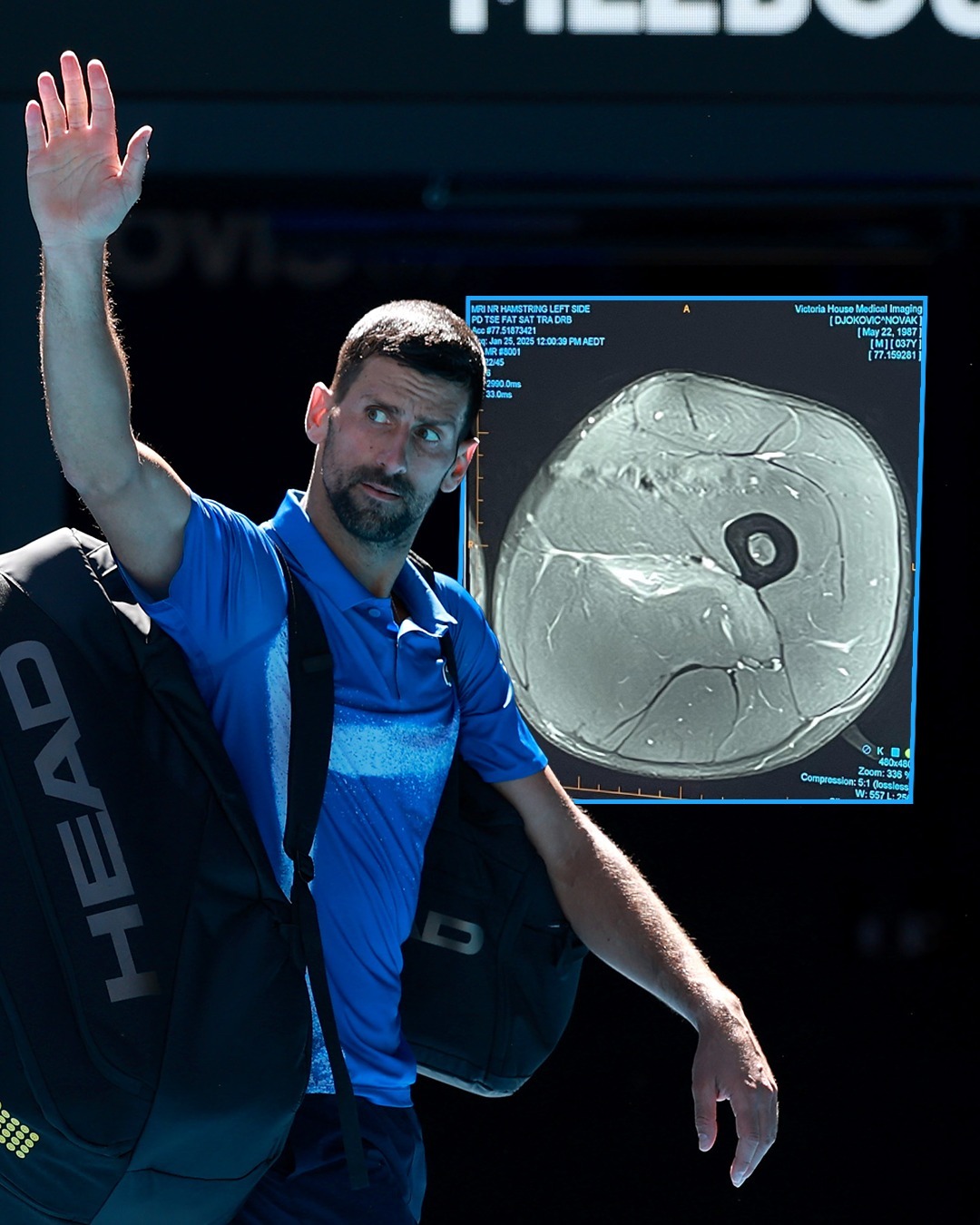 包含美网力克ATP总决赛,德约科维奇高光表现的词条 包含美网力克ATP总决赛,德约科维奇高光表现的词条